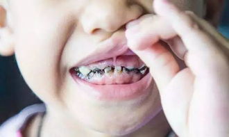 口腔護(hù)理可不是小事 聰明的媽媽從六個(gè)月開始就在科學(xué)保護(hù)